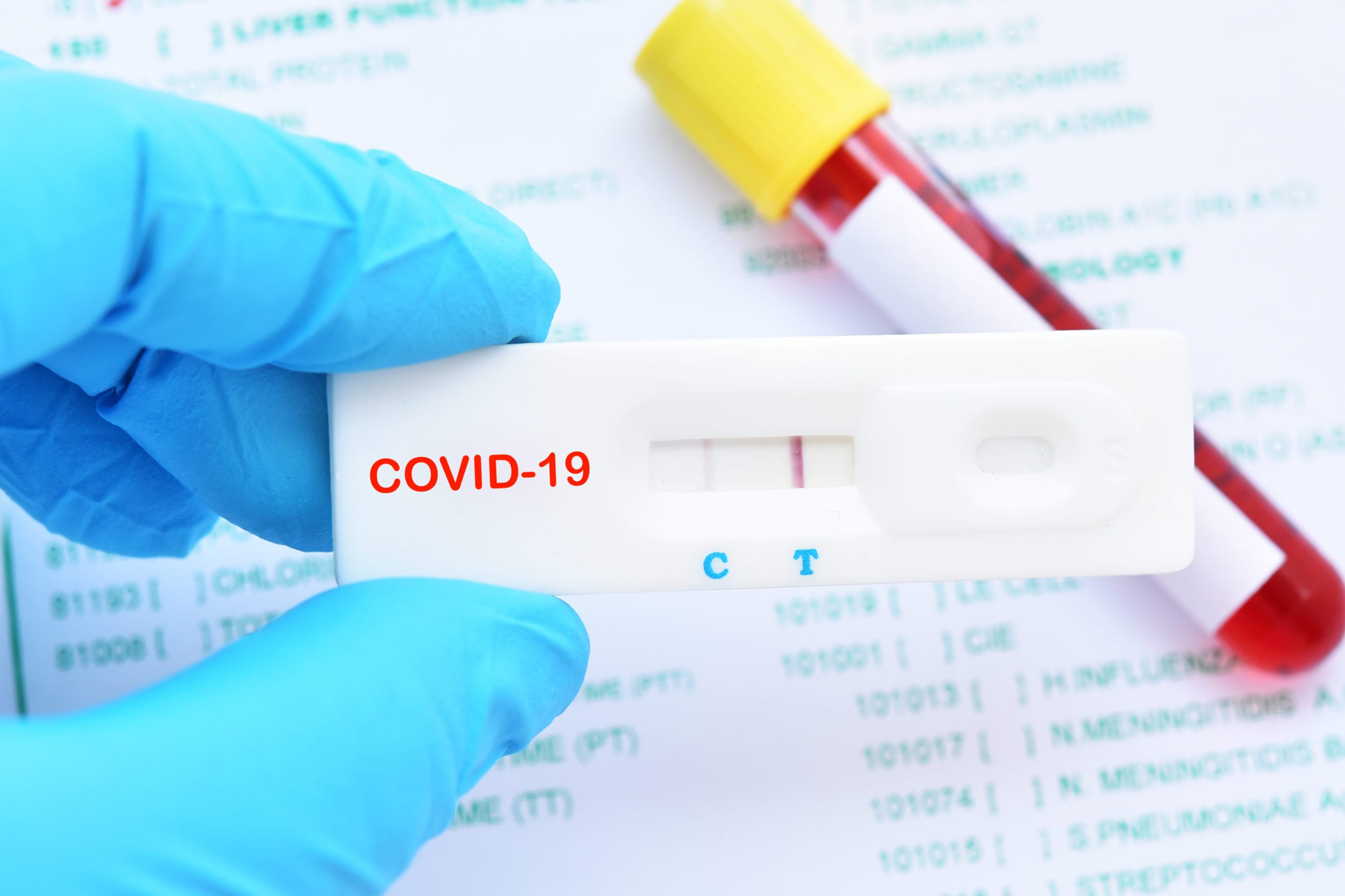 African Biosciences covid-19 antibody-test